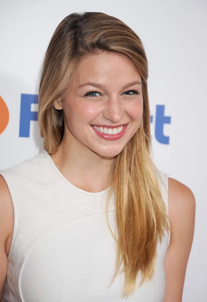 Melissa Benoist 15 Photos